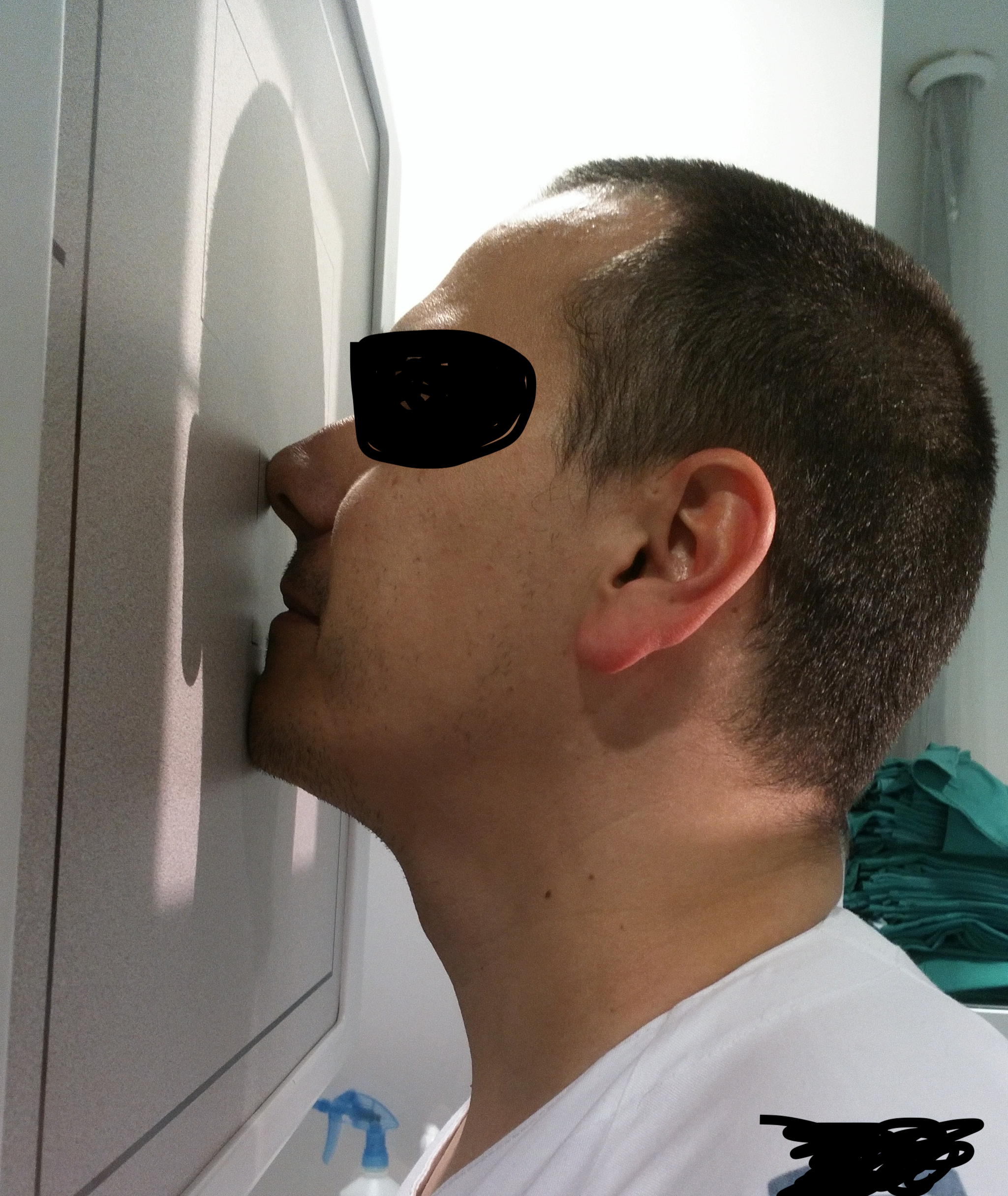 Paranasal sinuses anatomy